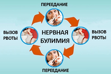 Лечение булимии в Давленканово